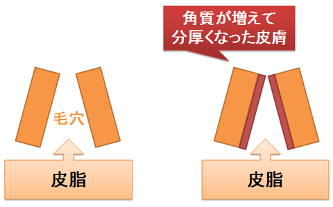 ディフェリン～角質が増えると毛穴が詰まりやすく