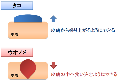 タコとウオノメ