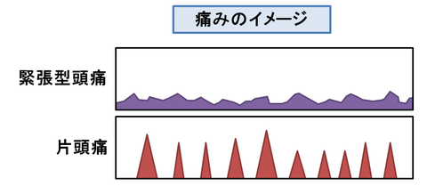 頭痛の痛みイメージ