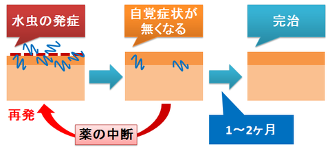 水虫の治療～自覚症状と再発の循環