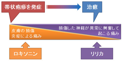 帯状疱疹後神経痛