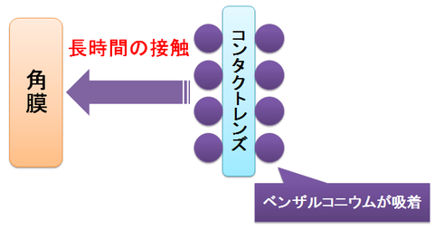 コンタクトレンズとベンザルコニウム