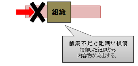 虚血再灌流２