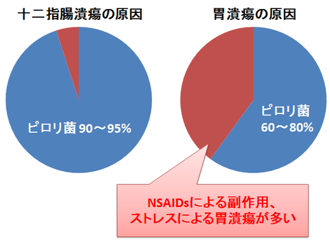 胃潰瘍と十二指腸潰瘍の原因